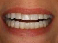 Konig Center for Cosmetic & Comprehensive Dentistry smile photos